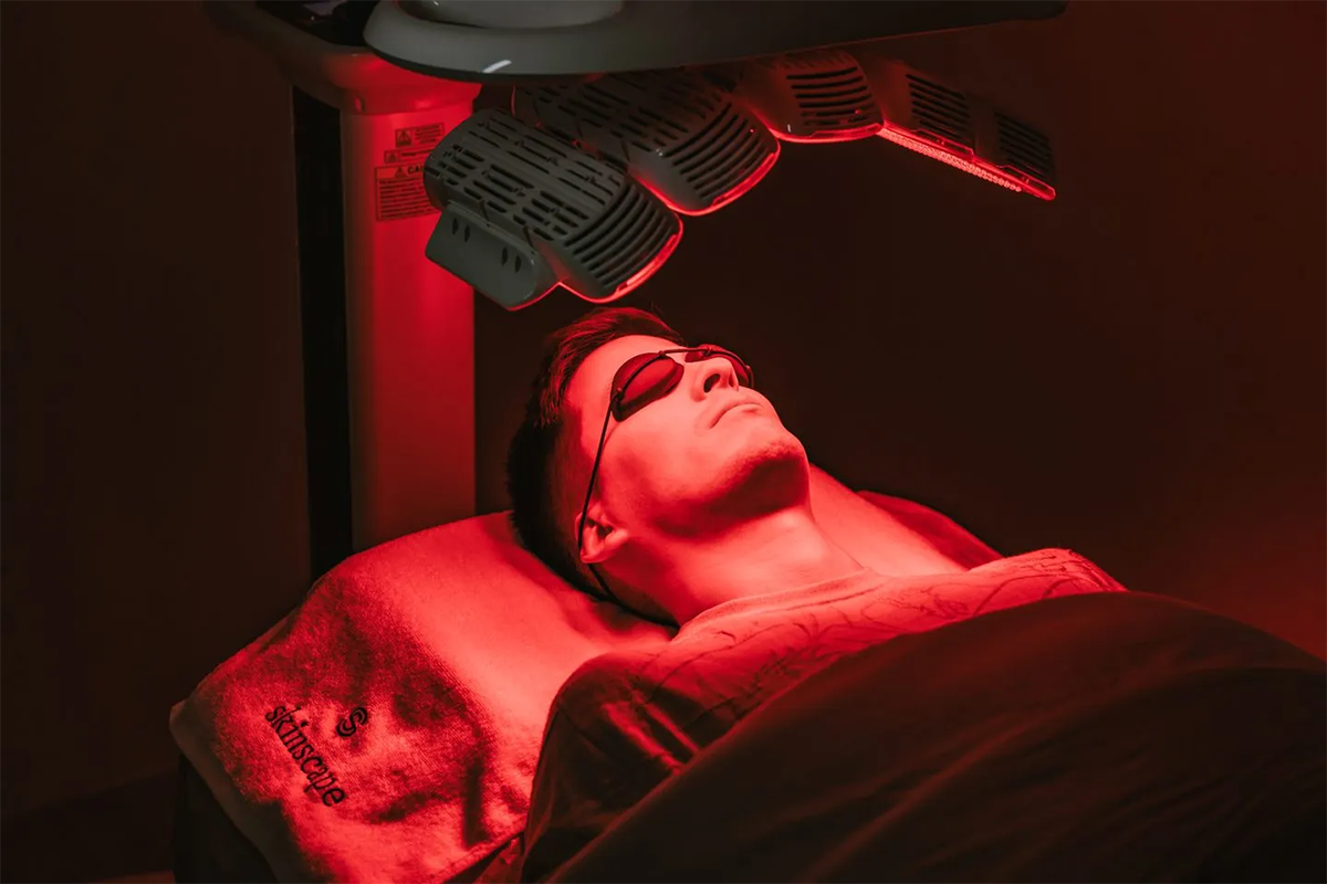 Photobiomodulation: Revolutionizing Hair Loss Treatment with Low-Level Laser Therapy