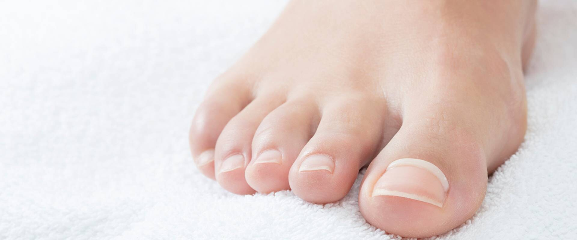 csm_onyfix-nagelkorrektur-header-startseite_370e90b972