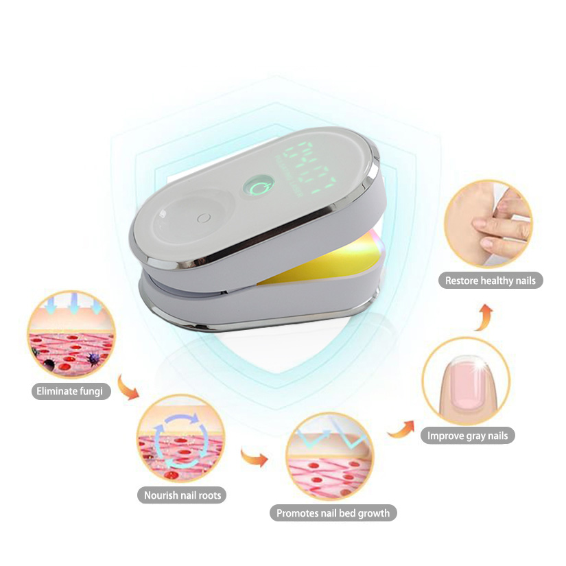 Revolutionizing Nail Health: Onychom Laser Device Brings a New Approach to Fungal Nail Treatment