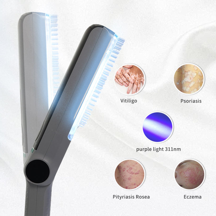 Expanding the Role of 311 nm UVB Phototherapy in the Management of Chronic Skin Conditions